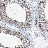 Anti-GOT2 antibody produced in rabbit Prestige Antibodies&#174; Powered by Atlas Antibodies, affinity isolated antibody, buffered aqueous glycerol solution