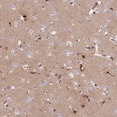 Anti-PRNP antibody produced in rabbit Prestige Antibodies&#174; Powered by Atlas Antibodies, affinity isolated antibody, buffered aqueous glycerol solution