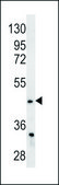 ANTI-FADS2 (CENTER) antibody produced in rabbit IgG fraction of antiserum, buffered aqueous solution