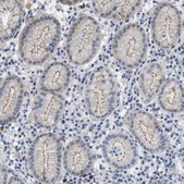 Anti-CRB3 antibody produced in rabbit Prestige Antibodies&#174; Powered by Atlas Antibodies, affinity isolated antibody, buffered aqueous glycerol solution