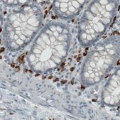 Monoclonal Anti-CD68 antibody produced in mouse Prestige Antibodies&#174; Powered by Atlas Antibodies, clone CL1338, purified immunoglobulin, buffered aqueous glycerol solution