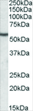 Anti-Desmin antibody produced in goat