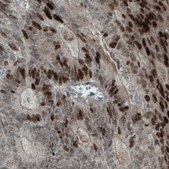 Monoclonal Anti-NSD2 antibody produced in mouse Prestige Antibodies&#174; Powered by Atlas Antibodies, clone CL1063, purified immunoglobulin, buffered aqueous glycerol solution