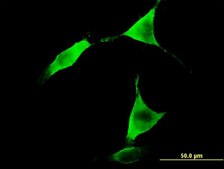 Monoclonal Anti-ALDH1L1 antibody produced in mouse clone 3E9, purified immunoglobulin, buffered aqueous solution