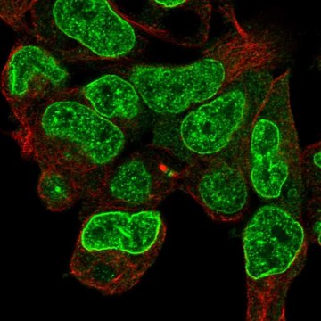 Anti-CPD antibody produced in rabbit Prestige Antibodies&#174; Powered by Atlas Antibodies, affinity isolated antibody