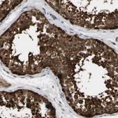 Anti-GARS antibody produced in rabbit Prestige Antibodies&#174; Powered by Atlas Antibodies, affinity isolated antibody, buffered aqueous glycerol solution