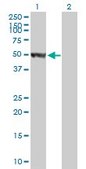 Anti-HARS antibody produced in mouse purified immunoglobulin, buffered aqueous solution