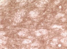Anti-Synuclein &#947; Antibody serum, Chemicon&#174;