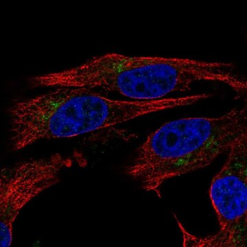 Anti-ENTPD6 antibody produced in rabbit Prestige Antibodies&#174; Powered by Atlas Antibodies, affinity isolated antibody