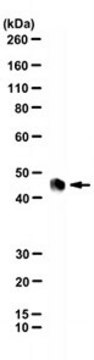 Anti-Rabies Virus Phosphoprotein Antibody, clone M974