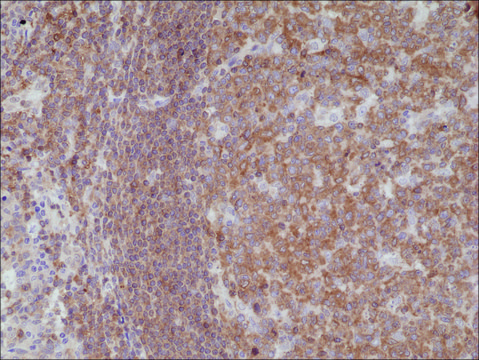 Anti-NF-kappa-B p105/p50 antibody, Rabbit Monoclonal recombinant, expressed in HEK 293 cells, clone RM299, purified immunoglobulin