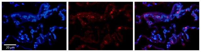 Anti-BCKDHA, (N-terminal) antibody produced in rabbit affinity isolated antibody