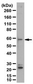 Anti-Glucagon receptor Antibody from rabbit, purified by affinity chromatography