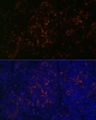 Anti-BTK antibody produced in rabbit