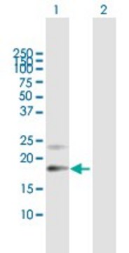 Anti-PTGDS antibody produced in mouse purified immunoglobulin, buffered aqueous solution