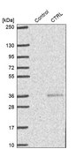 Anti-CTRL antibody produced in rabbit Prestige Antibodies&#174; Powered by Atlas Antibodies, affinity isolated antibody, buffered aqueous glycerol solution