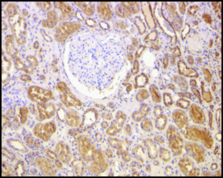 Anti-Bcl-2 (ab1) antibody produced in rabbit affinity isolated antibody, buffered aqueous solution