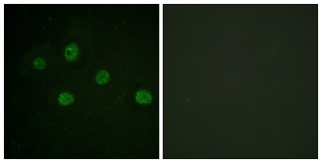 Anti-DNA-PK antibody produced in rabbit affinity isolated antibody
