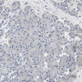 Anti-ALPL antibody produced in rabbit Ab2, Prestige Antibodies&#174; Powered by Atlas Antibodies, affinity isolated antibody, buffered aqueous glycerol solution