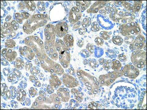 Anti-ST3GAL5 antibody produced in rabbit IgG fraction of antiserum