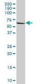 Anti-PPP2R5A antibody produced in mouse IgG fraction of antiserum, buffered aqueous solution