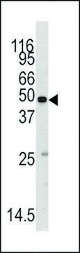 ANTI-METHIONYL TRNA SYNTHETASE(C-TERMINAL) antibody produced in rabbit purified immunoglobulin, buffered aqueous solution