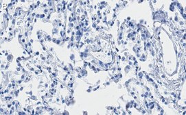 Anti-ITGA3 Antibody, clone 1D6 ZooMAb&#174; Rabbit Monoclonal recombinant, expressed in HEK 293 cells