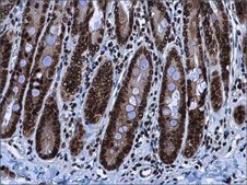 Anti-HMGA2 antibody produced in rabbit