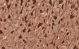 Anti-MAP2 Antibody, clone 3C19, ZooMAb&#174; Rabbit Monoclonal recombinant, expressed in HEK 293 cells