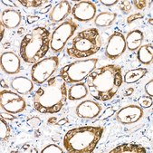 Anti-PGP9.5/UCHL1 Antibody, clone 2Q2S8, Rabbit Monoclonal