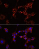 Anti-IGF1R antibody produced in rabbit