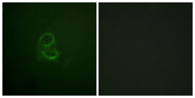 Anti-IL-4R antibody produced in rabbit affinity isolated antibody