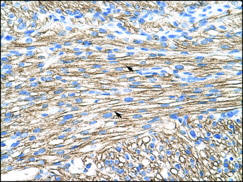 Anti-MBNL1 (AB1) antibody produced in rabbit affinity isolated antibody