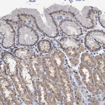 Anti-TSTD1 antibody produced in rabbit Prestige Antibodies&#174; Powered by Atlas Antibodies, affinity isolated antibody, buffered aqueous glycerol solution