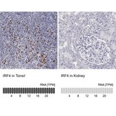 Anti-IRF4 antibody produced in rabbit Ab1, Prestige Antibodies&#174; Powered by Atlas Antibodies, affinity isolated antibody, buffered aqueous glycerol solution