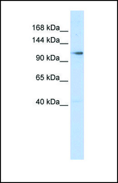 Anti-ZMIZ1 antibody produced in rabbit affinity isolated antibody