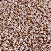 Anti-SLC2A2 antibody produced in rabbit Prestige Antibodies&#174; Powered by Atlas Antibodies, affinity isolated antibody, buffered aqueous glycerol solution