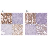 Anti-MYOM1 antibody produced in rabbit Prestige Antibodies&#174; Powered by Atlas Antibodies, affinity isolated antibody, buffered aqueous glycerol solution