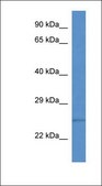 Anti-TMED1 antibody produced in rabbit affinity isolated antibody