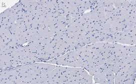 Anti-Dystrophin Antibody, clone 2C6 (MANDYS106) ZooMAb&#174; Mouse Monoclonal recombinant, expressed in HEK 293 cells