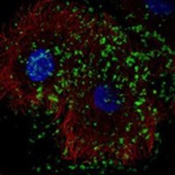 Anti-KLHDC7B antibody produced in rabbit Prestige Antibodies&#174; Powered by Atlas Antibodies, affinity isolated antibody, buffered aqueous glycerol solution