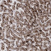 Anti-AGXT antibody produced in rabbit Prestige Antibodies&#174; Powered by Atlas Antibodies, affinity isolated antibody, buffered aqueous glycerol solution