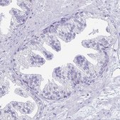 Anti-TFPI2 antibody produced in rabbit Prestige Antibodies&#174; Powered by Atlas Antibodies, affinity isolated antibody, buffered aqueous glycerol solution