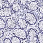 Anti-HLA-DQB2 antibody produced in rabbit Prestige Antibodies&#174; Powered by Atlas Antibodies, affinity isolated antibody, buffered aqueous glycerol solution