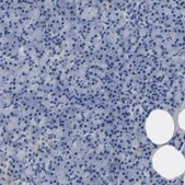 Anti-COL6A1 antibody produced in rabbit Prestige Antibodies&#174; Powered by Atlas Antibodies, affinity isolated antibody, buffered aqueous glycerol solution