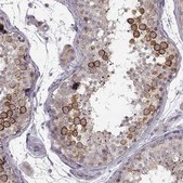 Anti-HMMR antibody produced in rabbit Prestige Antibodies&#174; Powered by Atlas Antibodies, affinity isolated antibody, buffered aqueous glycerol solution