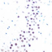 Anti-USP7/HAUSP antibody produced in rabbit