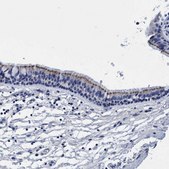 Anti-CROCC antibody produced in rabbit Prestige Antibodies&#174; Powered by Atlas Antibodies, affinity isolated antibody, buffered aqueous glycerol solution, Ab2