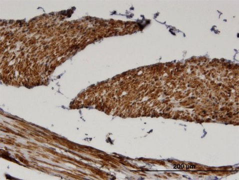 Monoclonal Anti-FADS1, (N-terminal) antibody produced in mouse clone 2D9, purified immunoglobulin, buffered aqueous solution