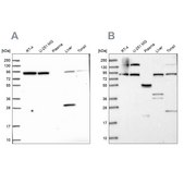 Anti-QARS antibody produced in rabbit Prestige Antibodies&#174; Powered by Atlas Antibodies, affinity isolated antibody, buffered aqueous glycerol solution